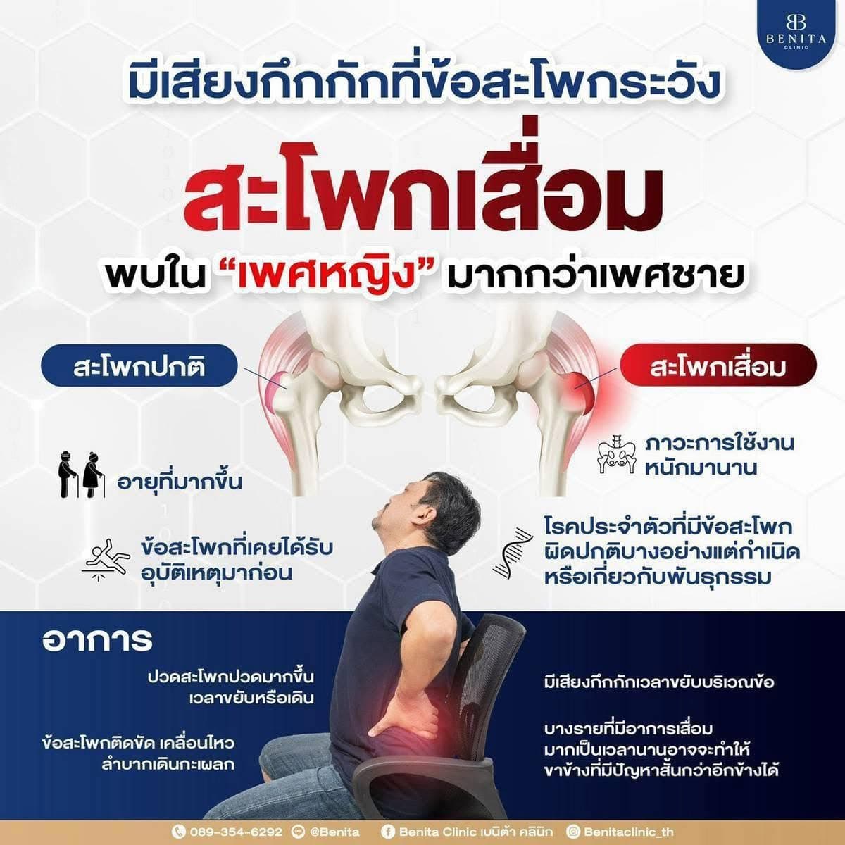 ภาพประกอบปวดหลัง ปวดสะโพก