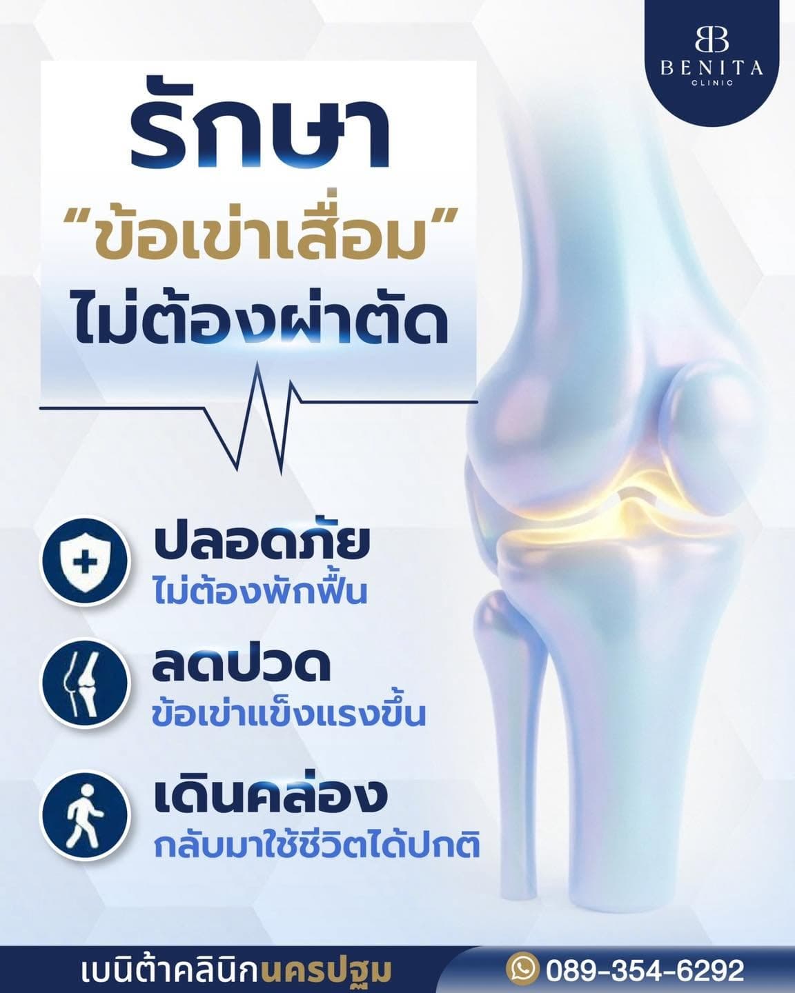ภาพประกอบข้อเข่าเสื่อม