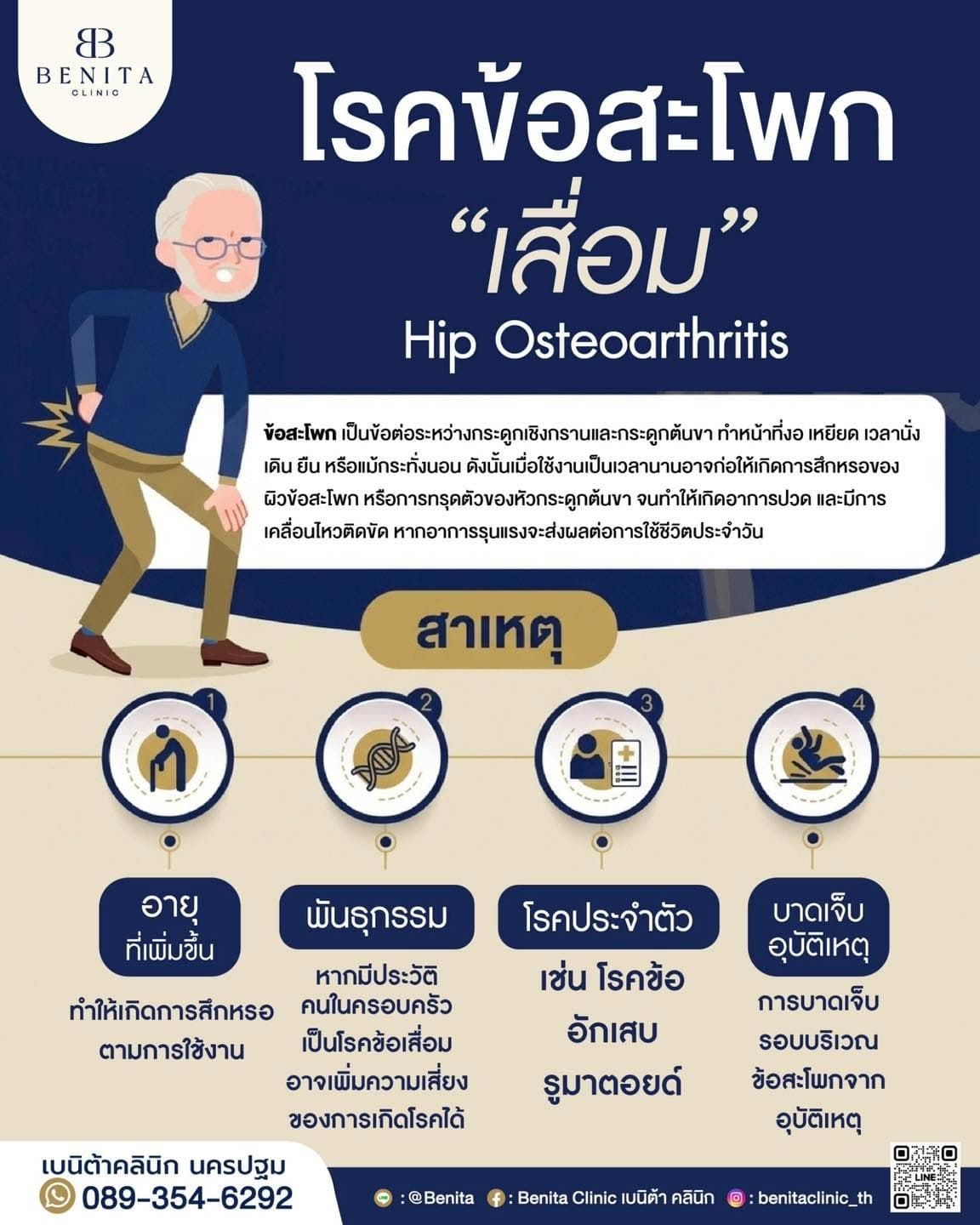 ภาพประกอบปวดหลัง ปวดสะโพก